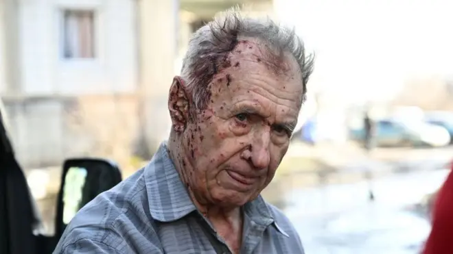 Este hombre, herido por los bombardeos en Chugúyev, espera ser atentido por los servicios de emergencia.