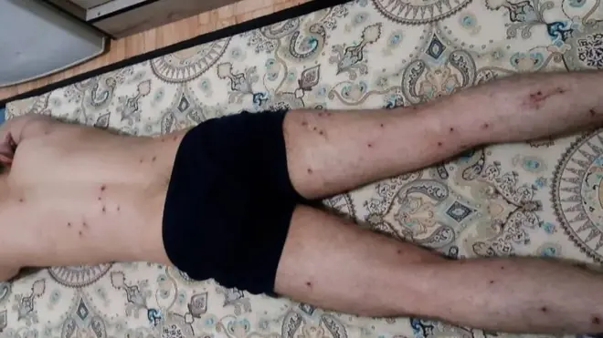 Раненый дробью