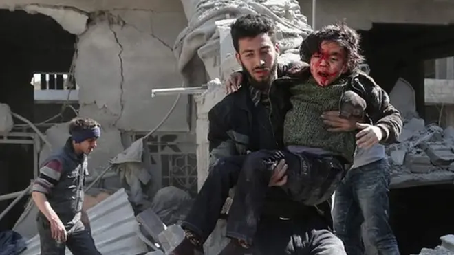 Жители Восточной Гуты сообщают, что удары наносятся по гражданским объектам