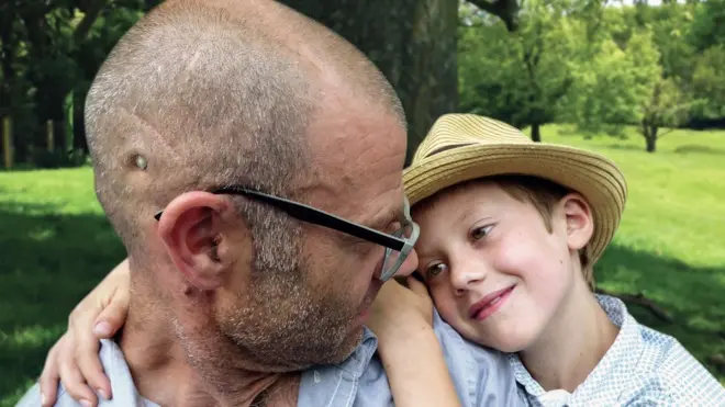 يصل الدواء إلى المخ عن طريق "منفذ" يوضع على جانب رأس المريض