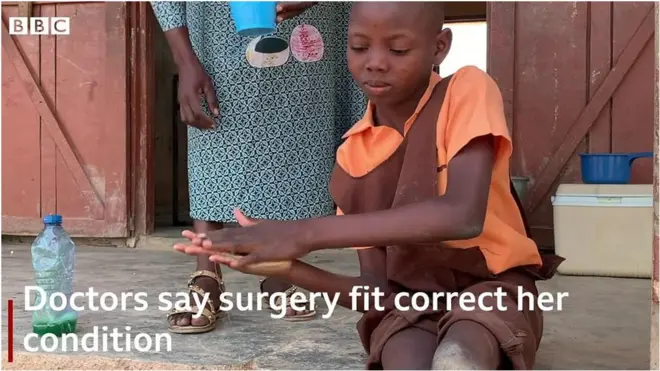 Agnes Mba shock her entire village after she wake up one day, wear school uniform, crawl on her bare knees go school to achieve en dreams.