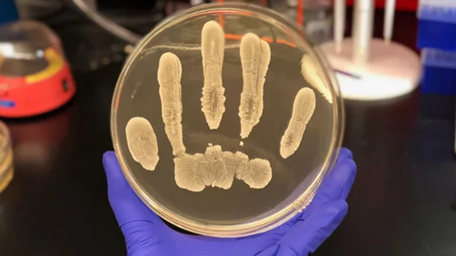 แบคทีเรีย Staphylococcus epidermidis ที่เติบโตในจานเพาะเชื้อ