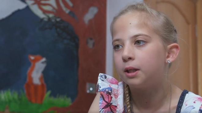 Lucy Groves, menina escocesa que tem a doença Protoporfiria Eritropoiética