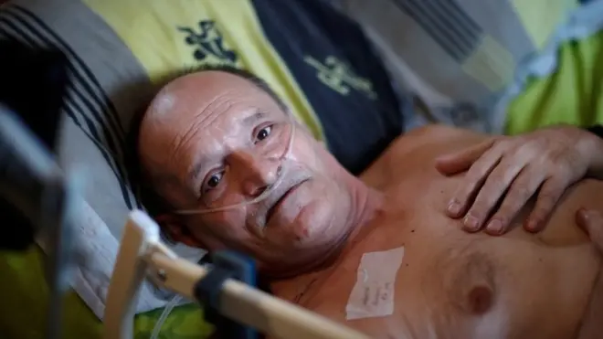 Alain Cocq, 57, suffers from a rare illness which causes the walls of his arteries to stick together