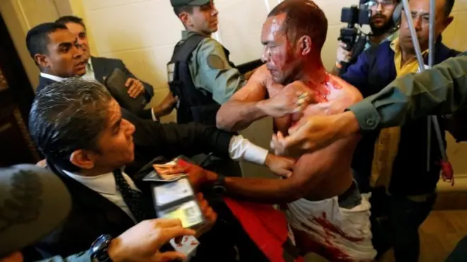 An injured government supporter tries to leave Venezuela's National Assembly after he and a group of others burst in on 5 July, 2017
