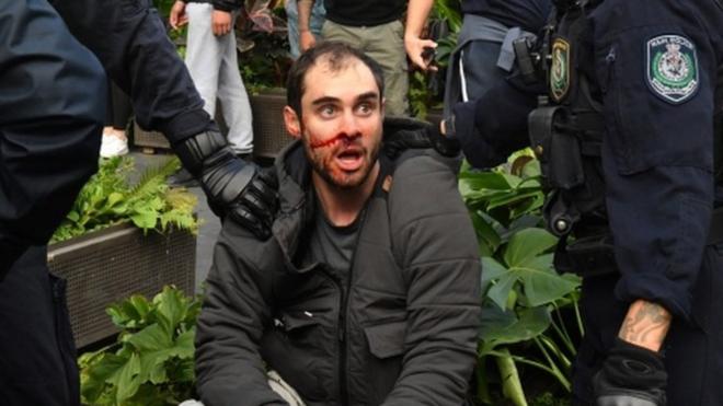 Australian detained during anti-lockdown protest in Sydney