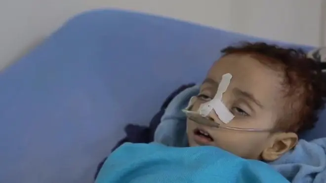 голод у Ємені