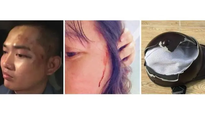 Nguyễn Tín, Phạm Đoan Trang nói bị công an Việt Nam đánh đêm 15/8 sau khi đi nghe đêm nhạc của Nguyễn Tín. Chiếc mũ bảo hiểm được cho là dùng để đánh bà Phạm Đoan Trang