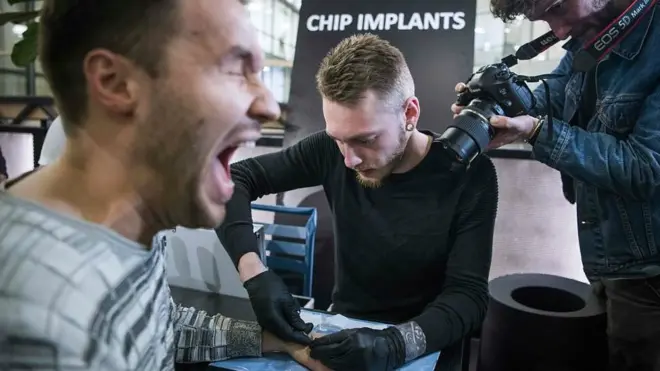 penanaman implan mikrochip