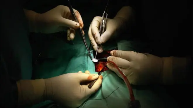 ډاکتران وايي، په خوړو کې له زیاتو غوړو ګټه اخیستنه، د سرې کړې غذا او ډېرو خوږو خوړل او د منظم سپورټ نه کول د زړه د ناروغۍ لوی لاملونه دي.