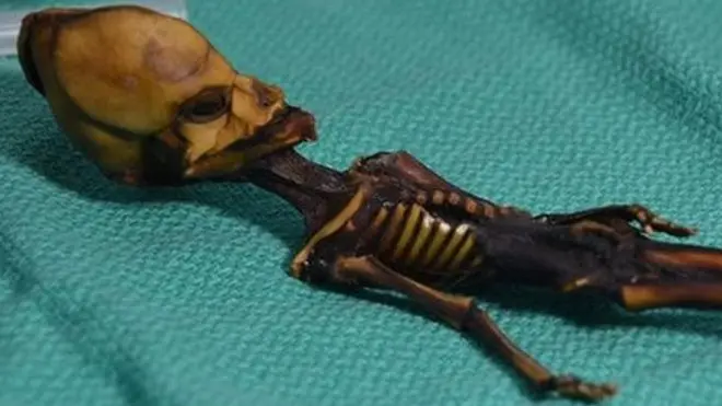 Аналіз ДНК показав, що мумія належить новонародженій дівчинці з численними генетичними мутаціями