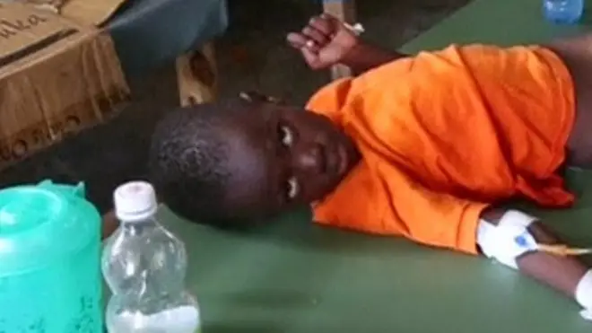 Niño enfermo en Haití