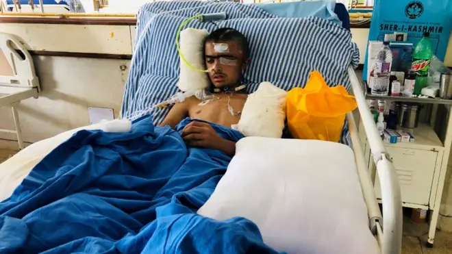 The Indian army and Asrar's family have conflicting versions of what caused his fatal injury