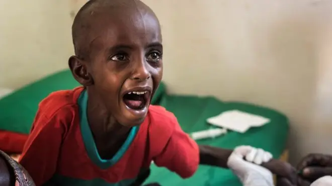 Abdullahi Mohamud llora al recibir una inyección en una clínica gubernamental en Somalia.