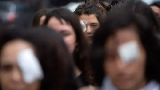 Protester in Chile wear eye patches to criticise the use of rubber bullets by the security forces