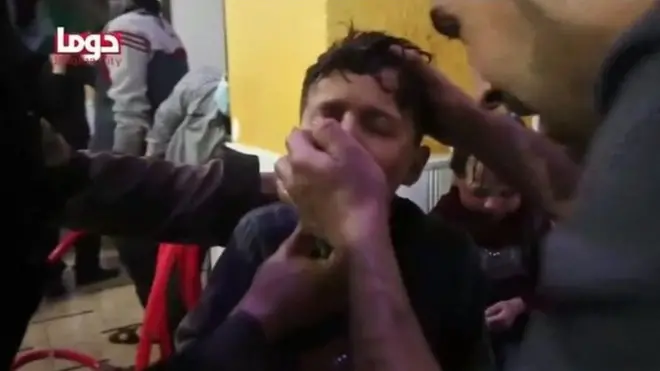 Gambar dari media sosial yang diakui sebagai anak-anak yang dirawat setelah serangan gas kimia.