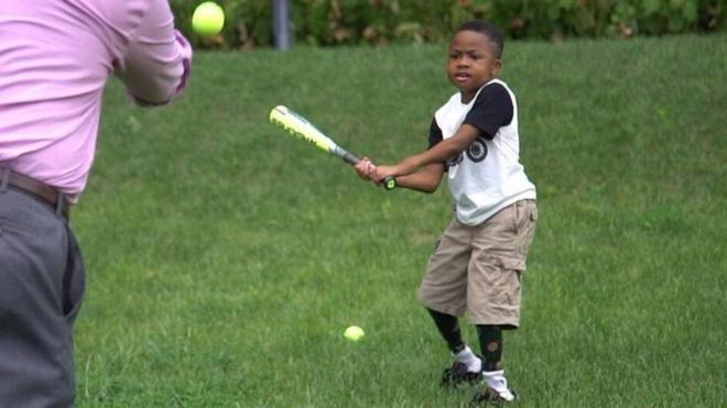The first child to undergo a double hand transplant was able to fulfil his dream of swinging a baseball bat just a year after surgery in Philadelphia.