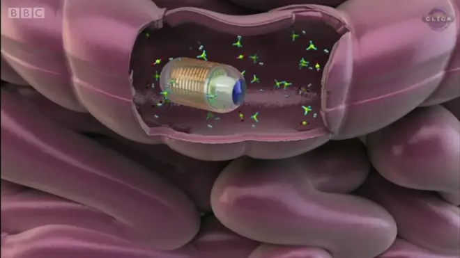 آنتوں میں بیماریوں کی تشخیص کے لیے کیپسول