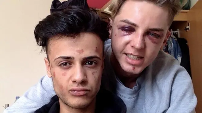 James and Dain after they were attacked
