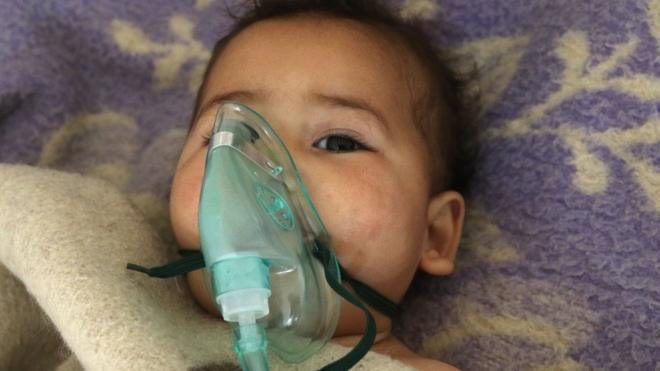 Ребенок в больнице в Сирии