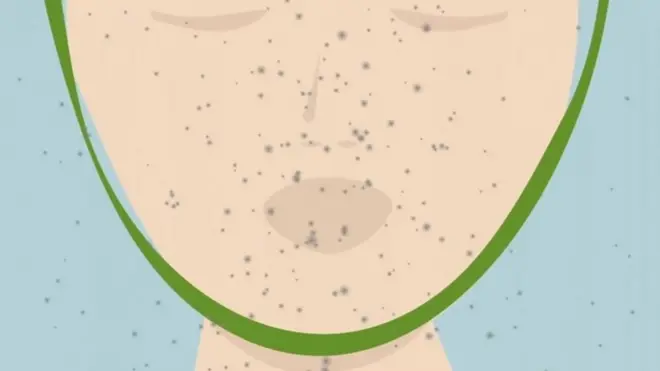 flu illustration