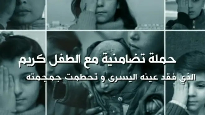 حملة تضامنية مع الطفل كريم