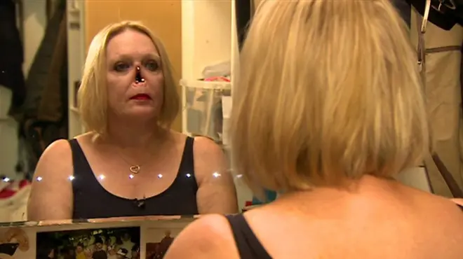 ผู้หญิงส่องกระจก สะท้อนให้เห็นภาพหน้าที่ไม่มีจมูก