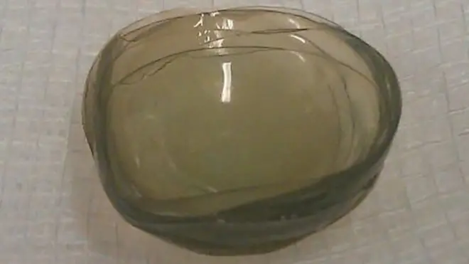 أوضح تقرير نشر في المجلة الطبية البريطانية أن المرأة ظلت ترتدي عدسات لاصقة تستخدم لمرة واحدة فقط لمدة 35 عاما