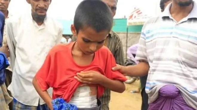 रोहिंग्या