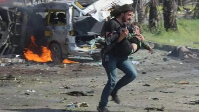 Fotografer asal Suriah Abd Alkader Habak menggendong seorang anak ke tempat aman setelah sebuah konvoi bis yang membawa pengungsi dari kampung-kampung di Suriah dibom.