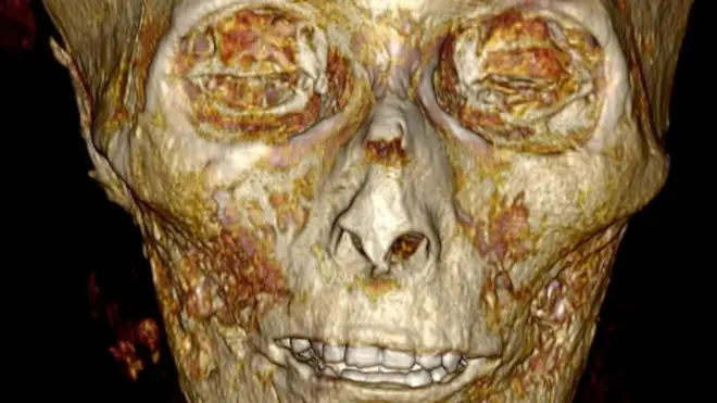 Череп Аменхотепа I на снимке компьютерной томографии