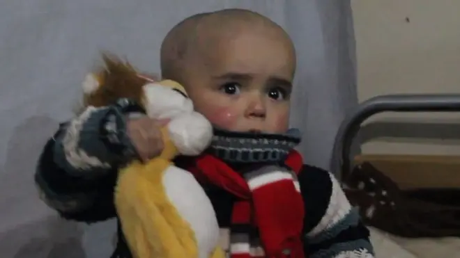 مرضى السرطان الغوطة الشرقية