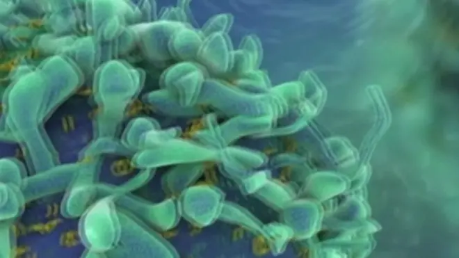 ایڈز کا وائس