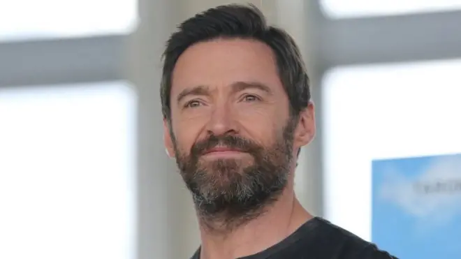 كان الفنان الأسترالي هيو جاكمان نجماً موسيقياً حاصلاً على جوائز قبل خوضه مجال التمثيل