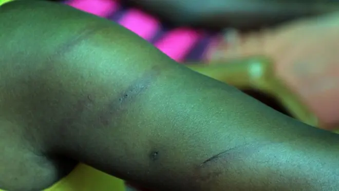 මැයි 9 ප්‍රහාරය :'ගෝඨාගෝගම වින්දිතයින්ට පොලිසිය වන්දි ගෙවිය යුතුයි' - ශ්‍රී ලංකා මානව හිමිකම් කොමිෂන් සභාව