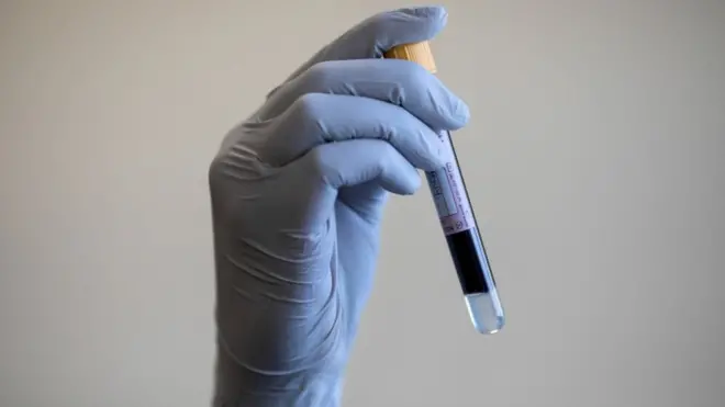 ตัวอย่างเลือด