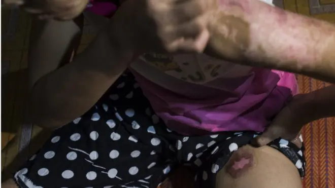 အပူအအေးလွန်ကဲတာ၊ ဆူညံသံ များတာ၊ အခိုးအငွေ့ဖုန်ငွေ့တွေ ကိုရှုရှိုက်ရတာ၊ အလုံပိတ်အခန်းနဲ့ အမြင့်တက်လုပ်ကိုင်ရတဲ့ လုပ်ငန်းတွေမှာ လုပ်ကိုင်နေရတဲ့အပြင် ခေါင်းပုံဖြတ်ခံရတာတွေ လည်းရှိနေတ