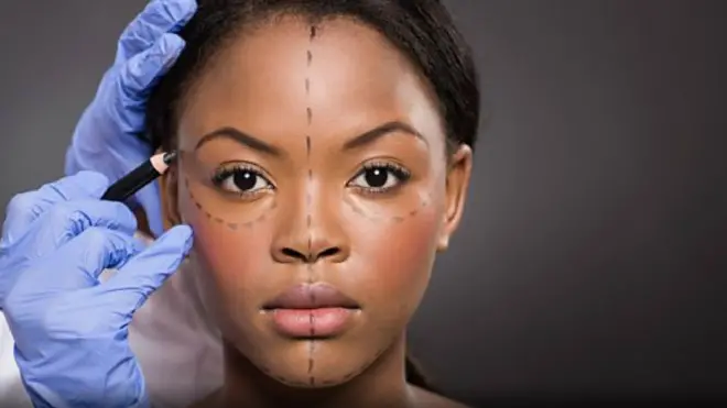 कॉस्मॅटिक सर्जरी