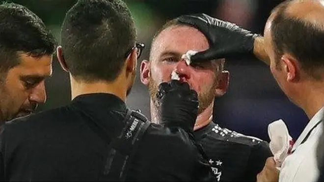 Rooney akipokea matibabu