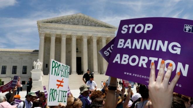A protester outside the Supreme Court in Washington DC holds a sign reading, "Stop banning abortion"