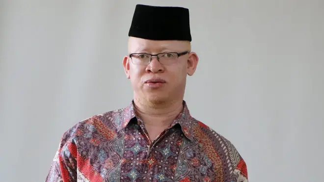 Anasema babake alikataa kuendelea kumpa malezi akidai kwamba ‘hakutaka kumlea mtoto aliyefanana na nguruwe’.