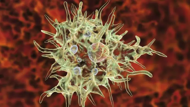 La meningoencefalitis amebiana primaria tiene un altísimo índice de mortalidad