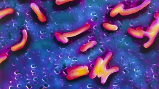 कोलेराको जीवाणुले सानो आन्द्रामा सङ्क्रमण गर्छ