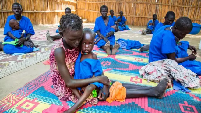 Güney Sudan'da açlık çeken çocuklar