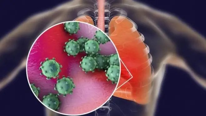 ภาพจำลองเชื้อไวรัส