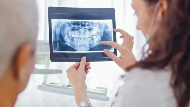 Diş röntgeni