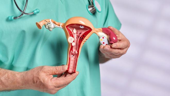 Un professionnel de la santé présente un modèle anatomique des organes reproducteurs féminins.