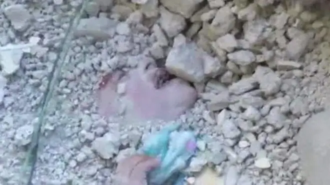 がれきに埋まった少女の救出シーン シリア・ダマスカスで