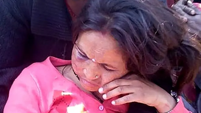 વિમાન દુર્ઘટનામાં બચી ગયેલાં પ્રવાસી મહિલાની તસવીર