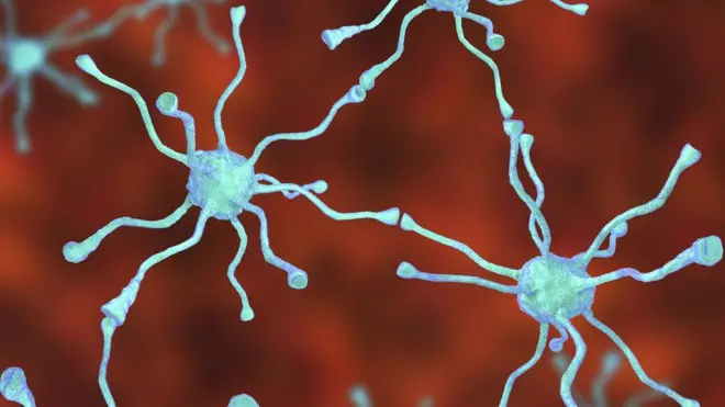 Tiba ya kutumia seli ya Ubongo, 'matumaini kwa ' kwa maradhi ya kutetemeka.